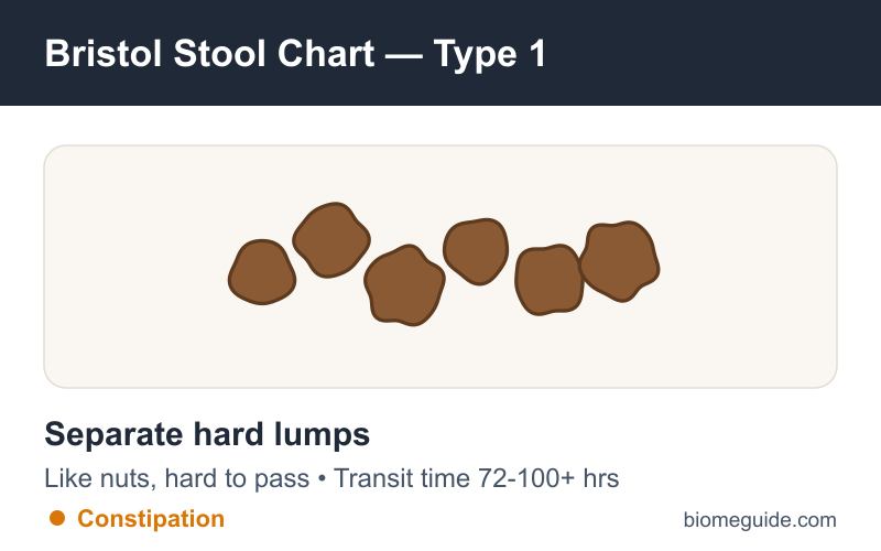 Bristol Stool Chart Type 1: separate hard lumps like nuts, indicating severe constipation.