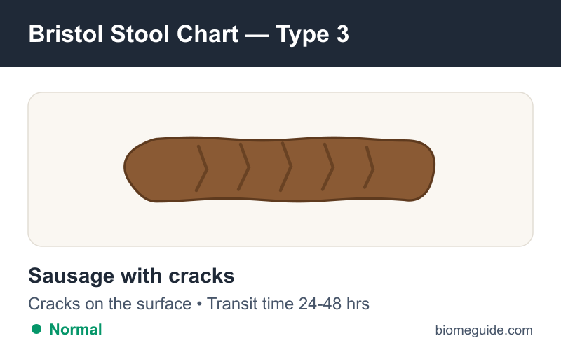 Bristol Stool Chart Type 3: a sausage-shaped stool with cracks on the surface, considered normal.