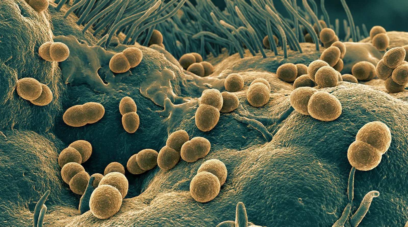 Scientifically accurate microscopy-style illustration of Bordetella pertussis showing its characteristic tiny gram-negative coccobacillus