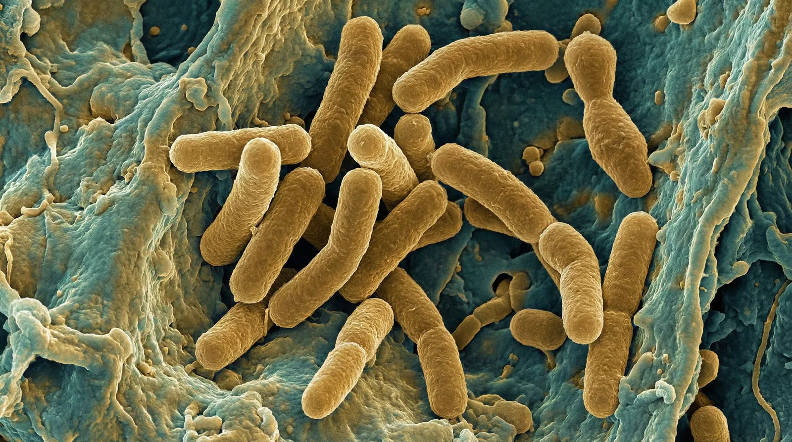Scientifically accurate microscopy-style illustration of Cutibacterium acnes showing its characteristic gram-positive pleomorphic rod