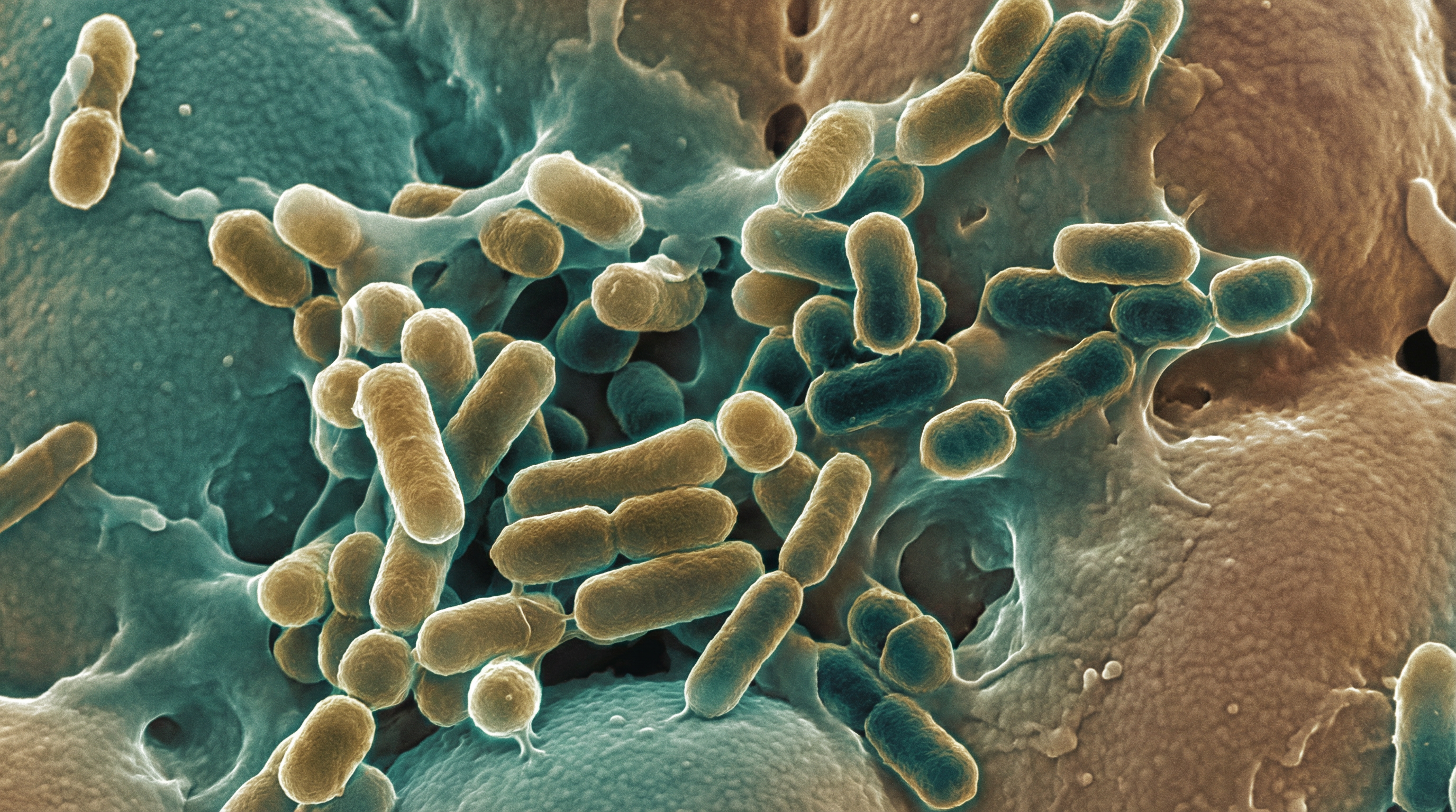 Scientifically accurate microscopy-style illustration of Gardnerella vaginalis showing its characteristic gram-variable small pleomorphic rod to coccobacillus