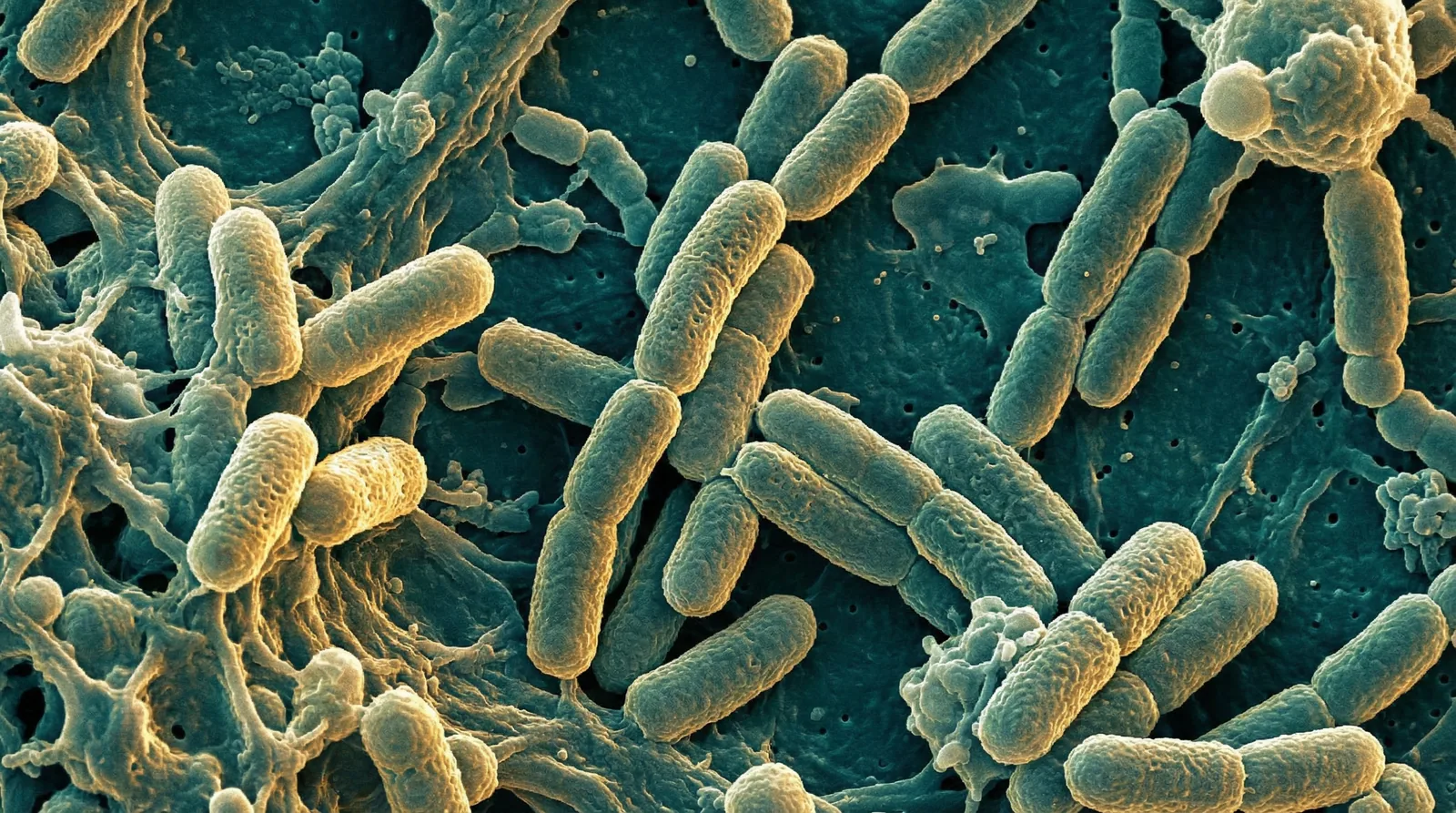 Scientifically accurate microscopy-style illustration of Lactobacillus casei/paracasei showing its characteristic gram-positive rod-shaped bacterium