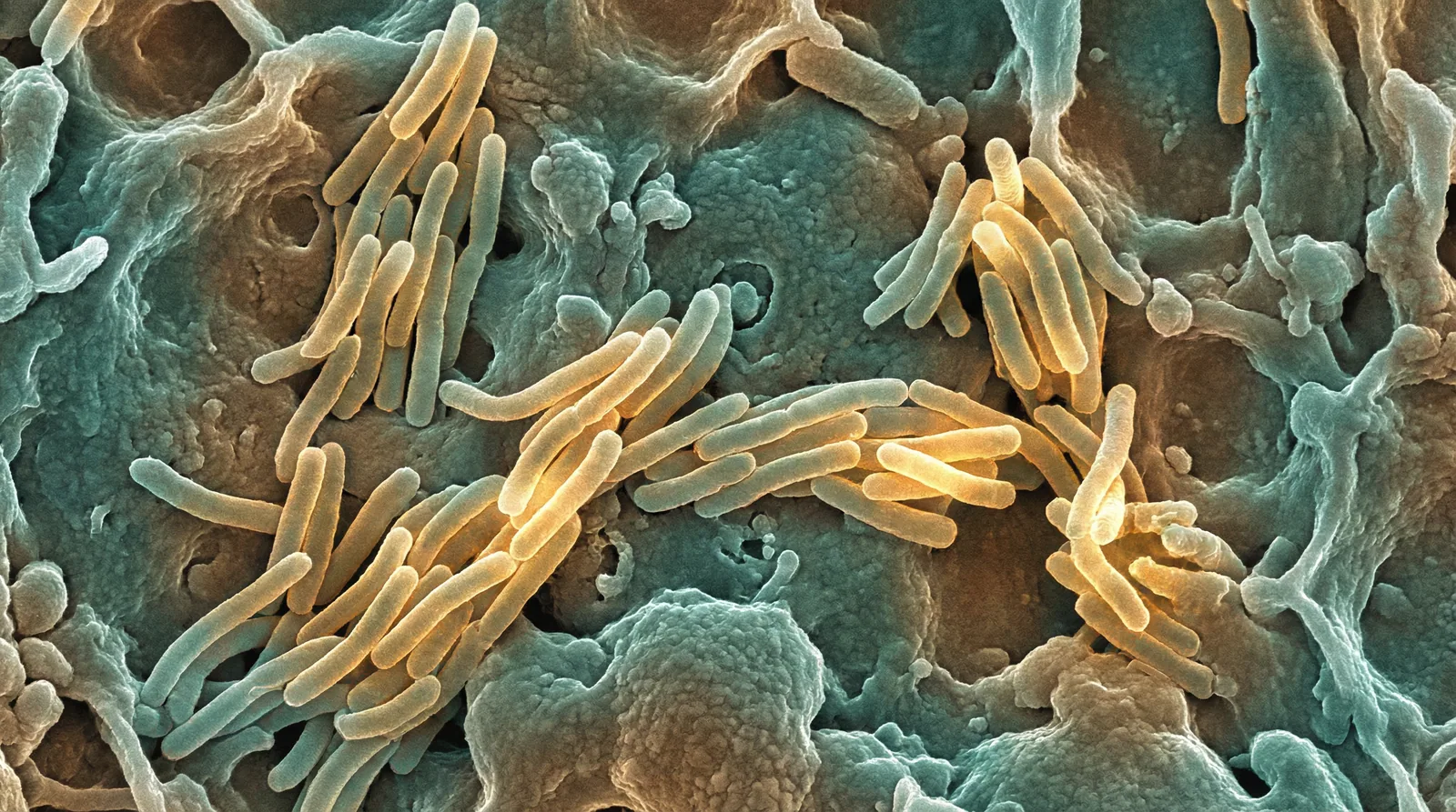 Scientifically accurate microscopy-style illustration of Mycobacterium leprae showing its characteristic acid-fast rod-shaped bacterium