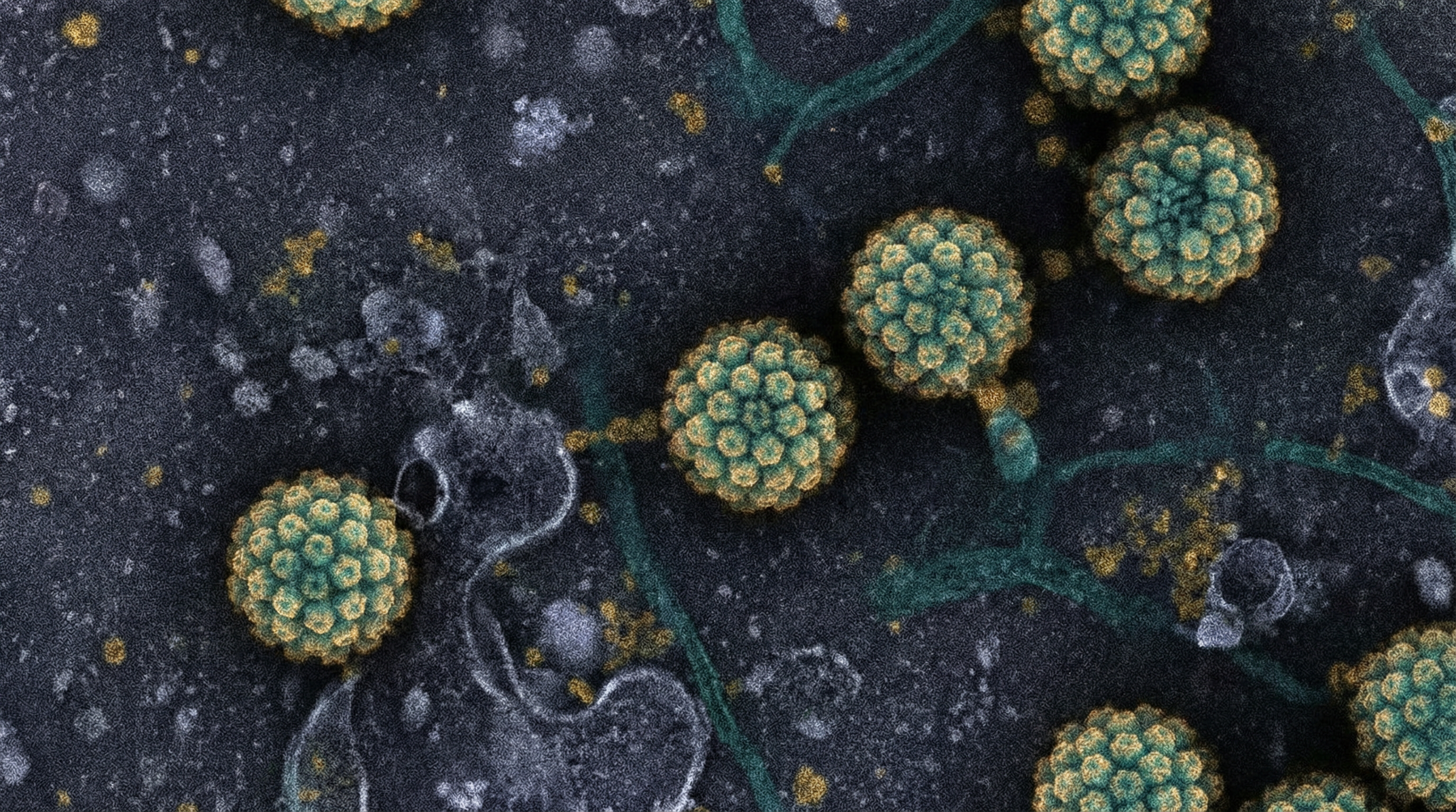 Scientifically accurate microscopy-style illustration of Papillomaviridae showing its characteristic small non-enveloped icosahedral virus with 72 capsomeres arranged in T=7 symmetry