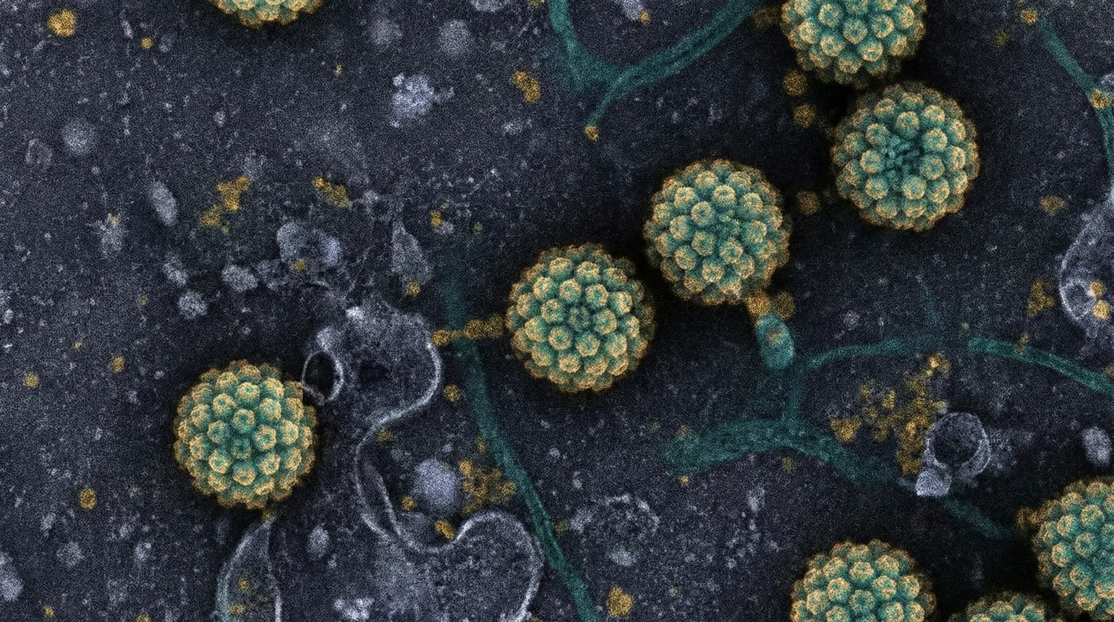 Scientifically accurate microscopy-style illustration of Papillomaviridae showing its characteristic small non-enveloped icosahedral virus with 72 capsomeres arranged in T=7 symmetry