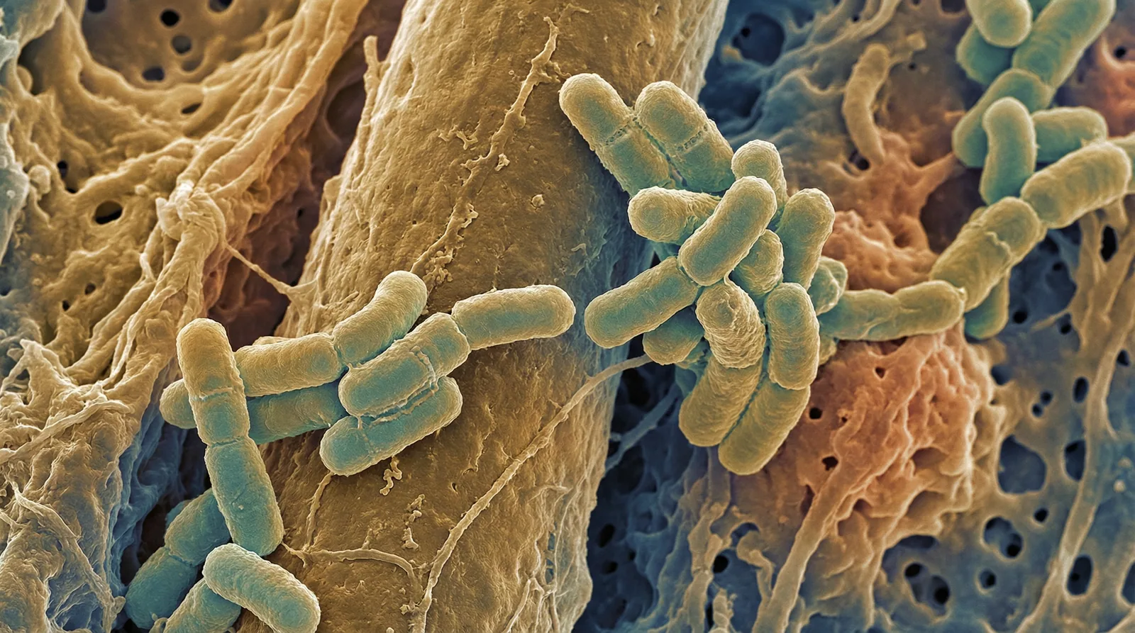 Scientifically accurate microscopy-style illustration of Propionibacterium acnes showing its characteristic gram-positive pleomorphic rod