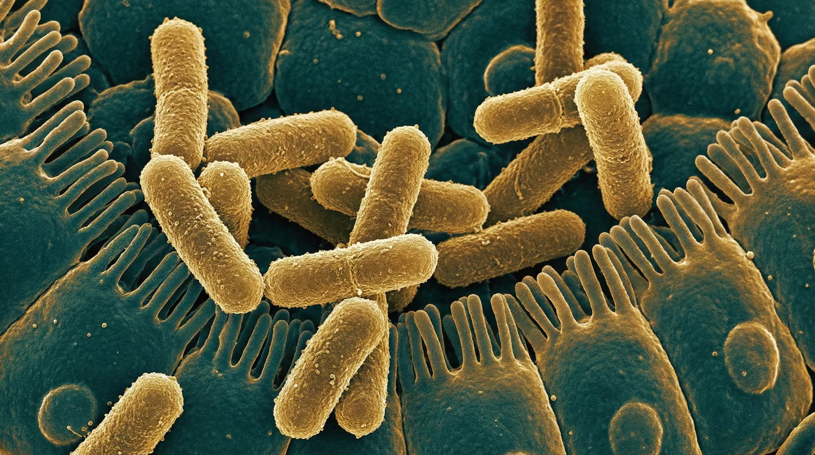 Scientifically accurate microscopy-style illustration of Shigella dysenteriae showing its characteristic gram-negative rod-shaped bacterium