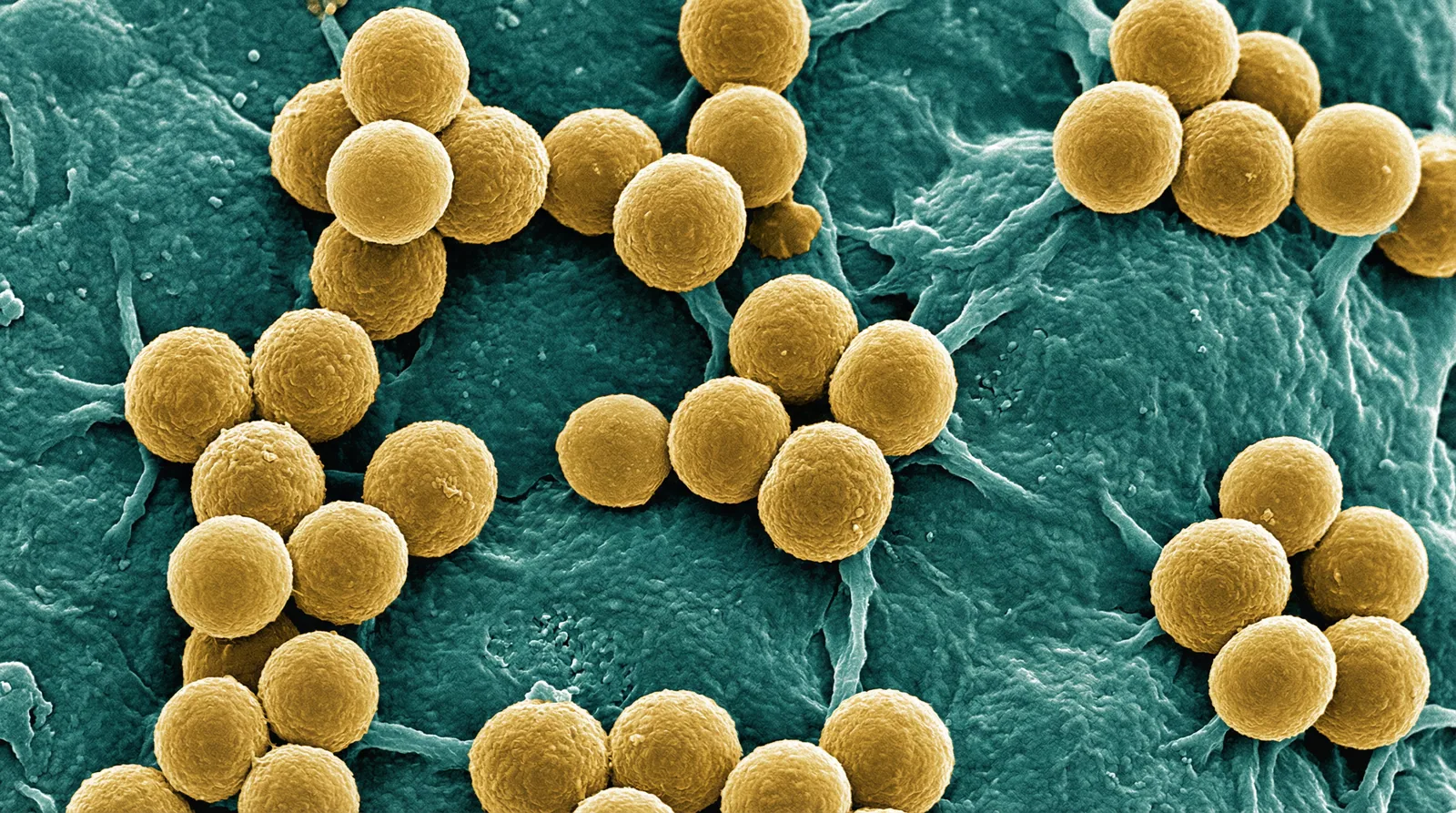 Scientifically accurate microscopy-style illustration of Staphylococcus hominis showing its characteristic gram-positive spherical coccus in clusters or tetrads